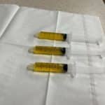 3 PRP syringes, PRP injections side effects