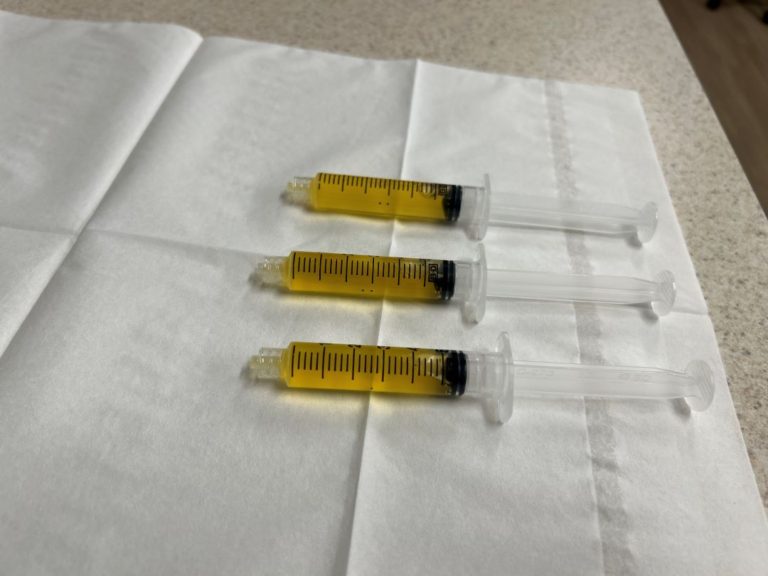 3 PRP syringes, PRP injections side effects