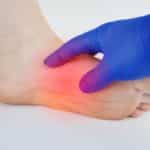 PRP for plantar fasciitis foot pain Knoxville, TN