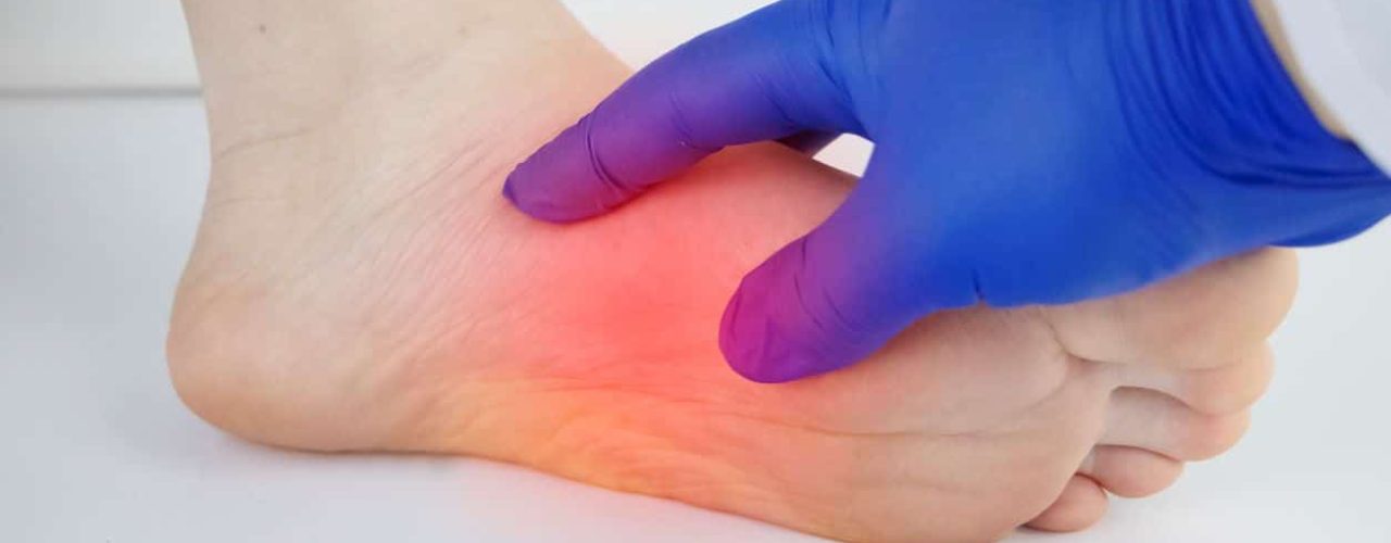 PRP for plantar fasciitis foot pain Knoxville, TN